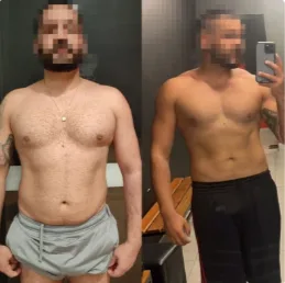 Antes e depois de paciente que ganhou definição muscular