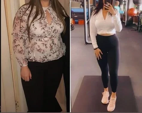 Antes e depois de paciente que ganhou disposição para treinar