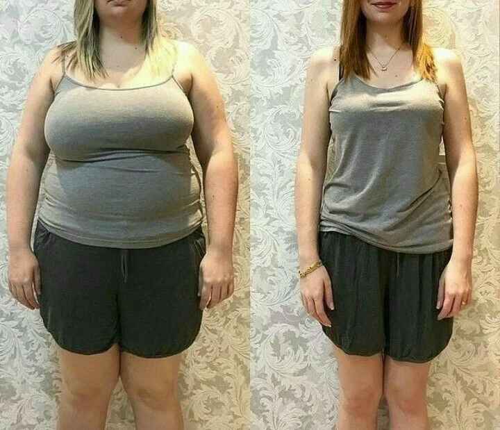 Antes e depois de paciente que ganhou massa muscular e definição